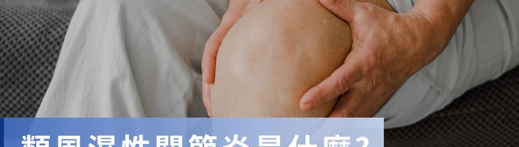 類風濕性關節炎是什麼？原因、診斷基準、改善方法解析