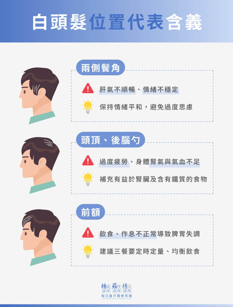 白頭髮位置代表含義